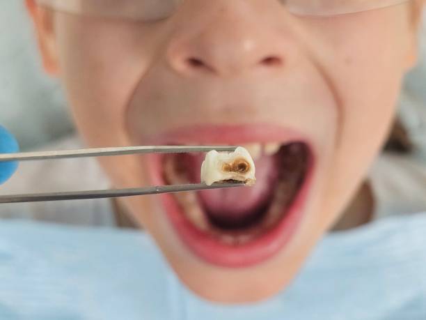 Best Pediatric Emergency Dentist in Sea Ranch, CA
